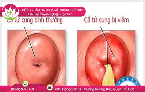 cac-benh-vung-kin-phu-nu